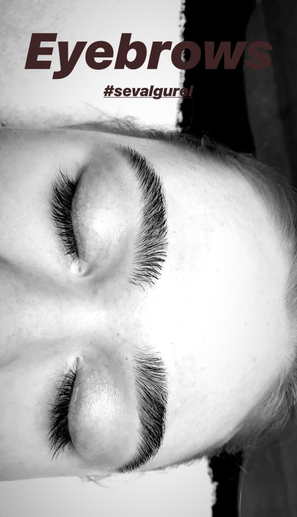 Kune efter korrektion af bryn