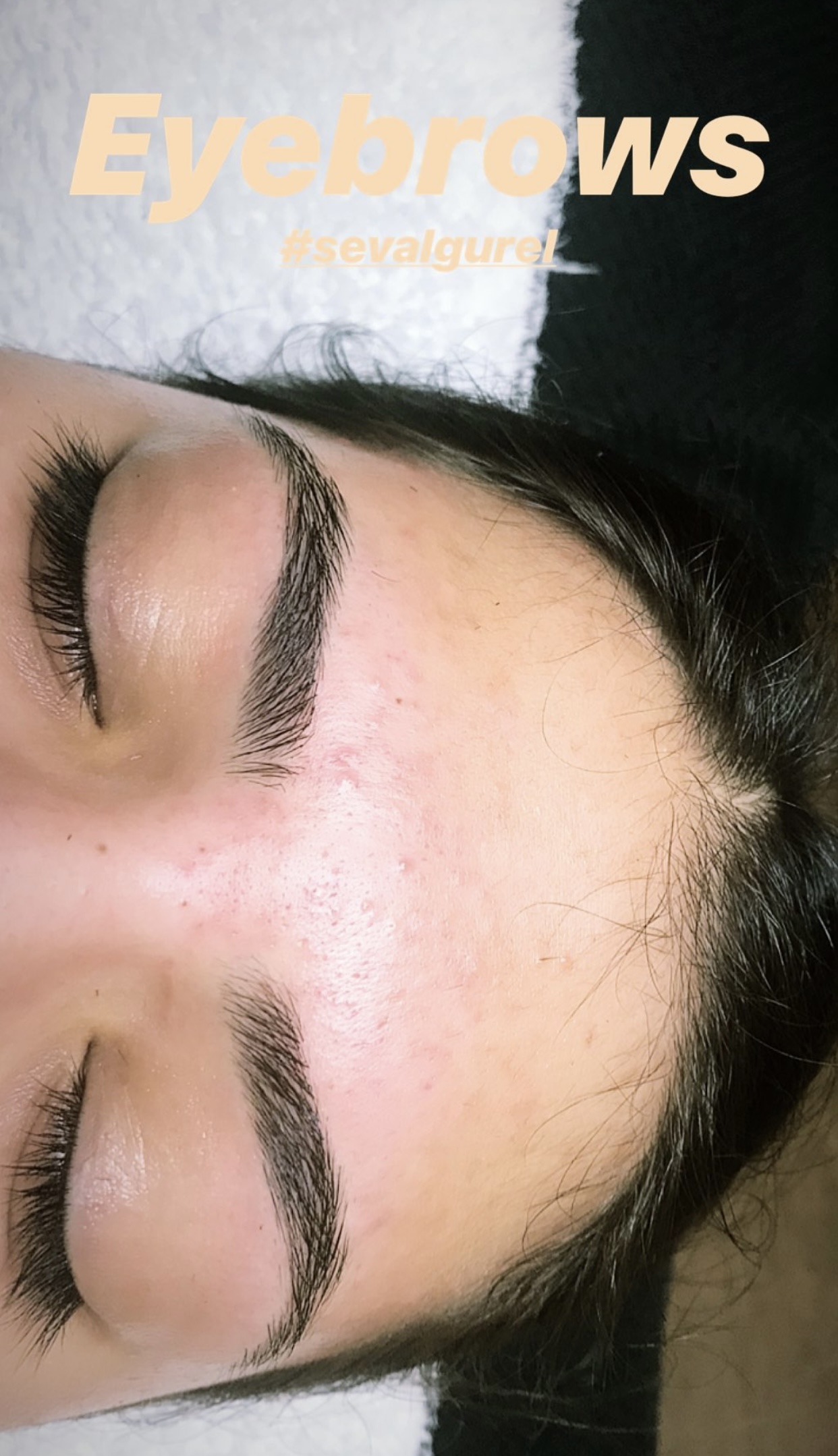 Kune efter korrektion af bryn