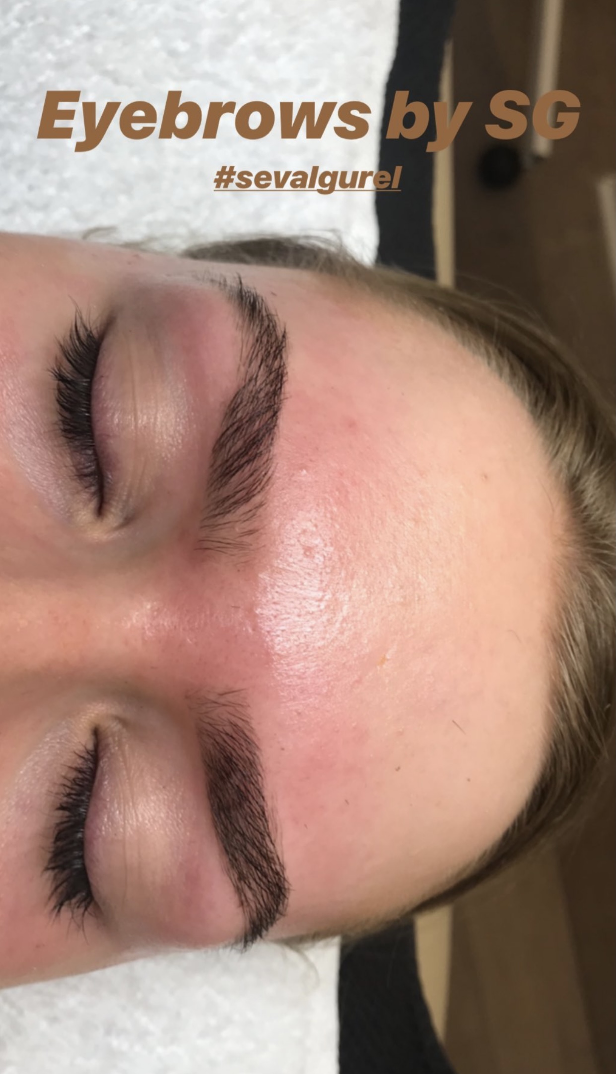 Kune efter korrektion af bryn